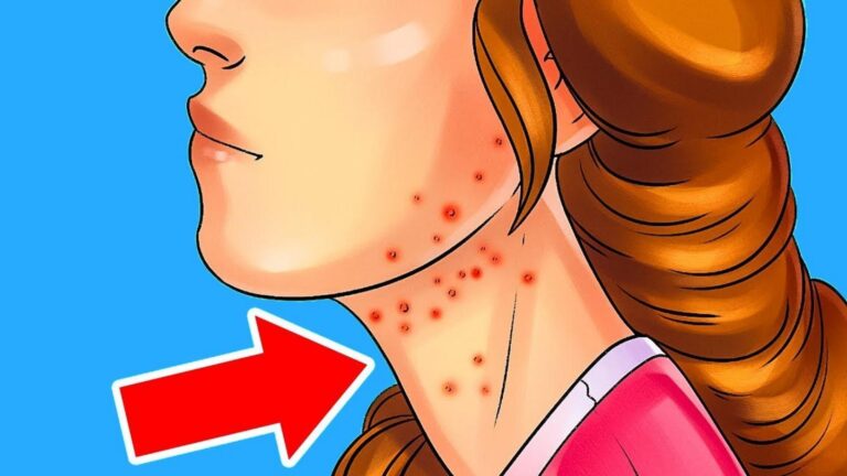 Questo semplice gesto rivela i segnali nascosti del diabete… scopri come proteggerti!