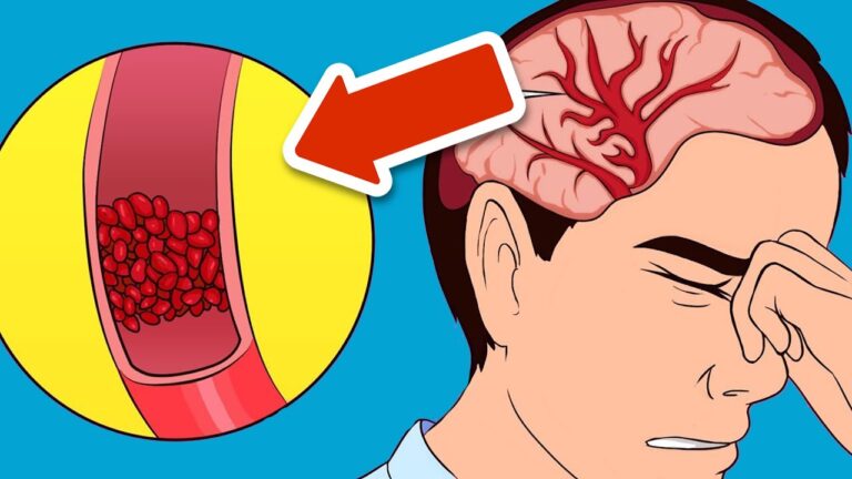 5 Strategi per Eliminare la Migraine in Meno di 5 Minuti! Scopri come!