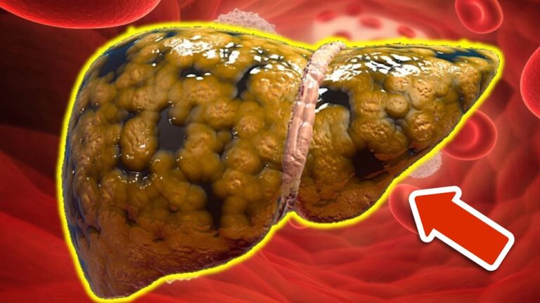 6 superfoods per una liver detox efficace e naturale! Scopri quali sono!