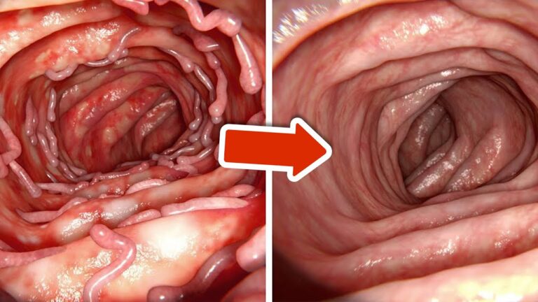 5 metodi naturali per pulire il tuo intestino in modo rapido e efficace