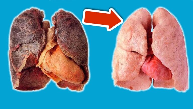 Pulizia polmoni: 7 giorni per respirare meglio e sentirsi rinati!