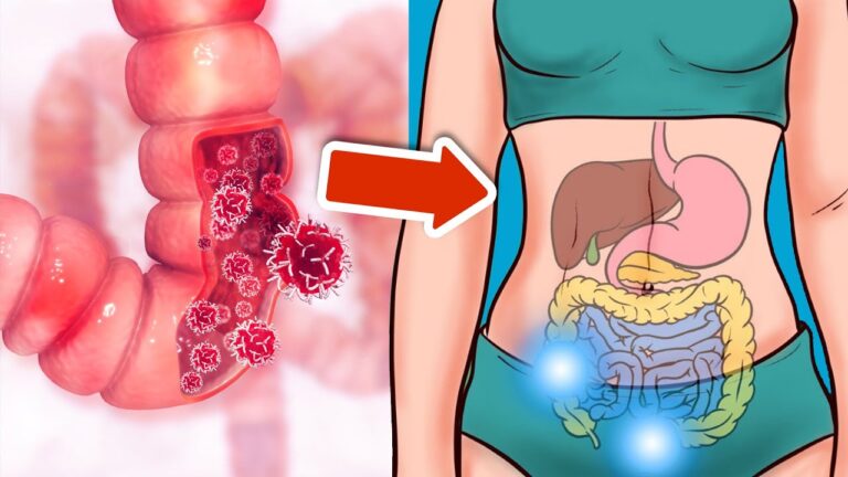 7 segnali per riconoscere il cancro del colon, non ignorarli mai!