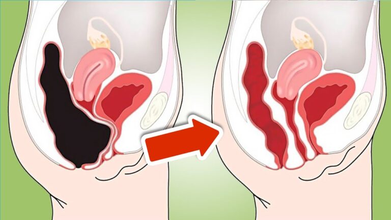 7 rimedi naturali per purificare l’intestino facilmente e senza sforzo!