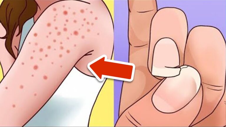 8 segnali di intolleranza al glutine da non ignorare assolutamente!