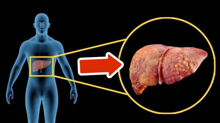 Scopri 5 segnali di allerta per la salute del fegato che non puoi ignorare!