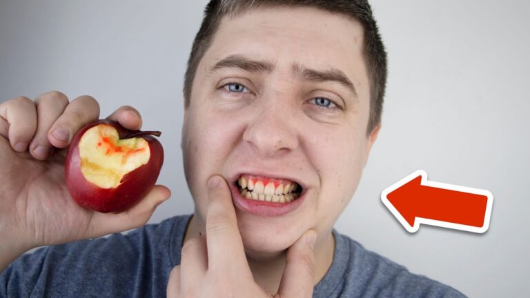 7 rimedi naturali per combattere il sanguinamento gengivale subito!