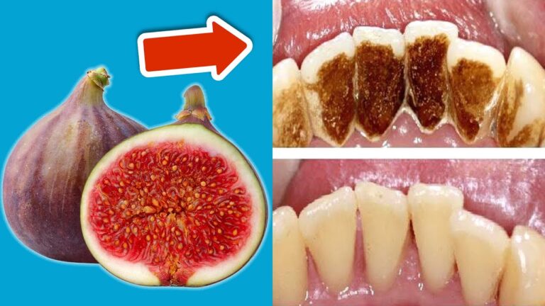 Rimuovi il tartaro: 5 semplici metodi per un sorriso splendente!