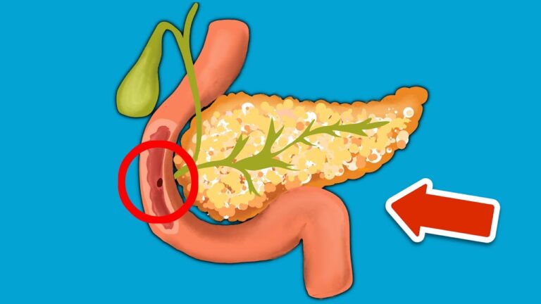 7 Segnali da non ignorare per la salute del pancreas: scopri cosa fare!