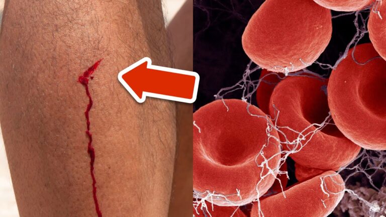 7 segni allarmanti di un coagulo di sangue che devi conoscere!