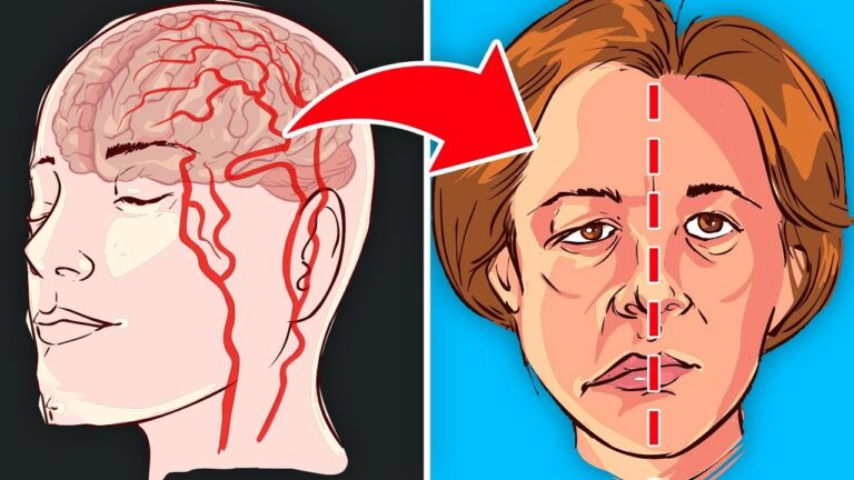 9 cibi essenziali per prevenire un ictus e migliorare la tua salute!