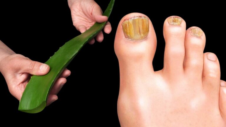 Scopri 7 benefici sorprendenti di questa pianta miracolosa per la salute!