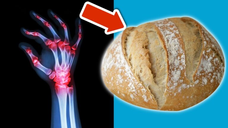Scopri i 4 alimenti da evitare per tenere sotto controllo l’artrite!